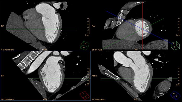 cardiac viewer thumbnail