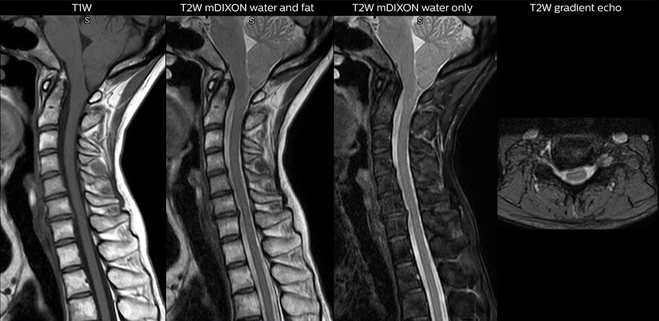 magnetic resonance for the ED