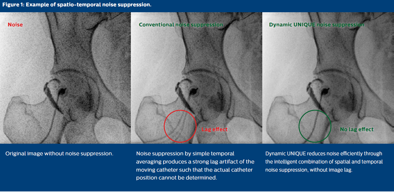 MultiVane image