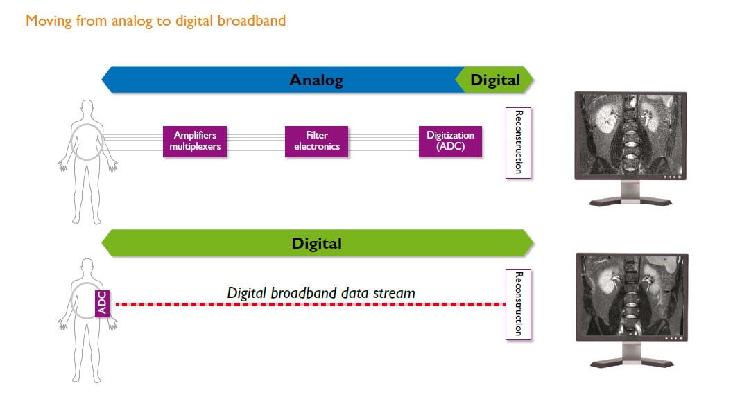 moving from analog to digital broadband