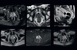 comprehensive mri clinical case