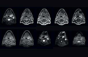 mri of head clinical case