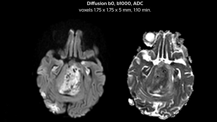 Diffusion image