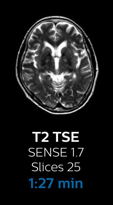 T2 TSE magnetic resonance imaging