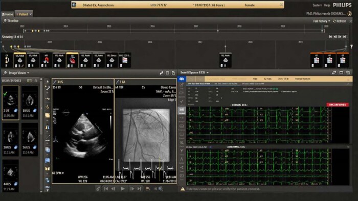 Cardiovascular Workspace