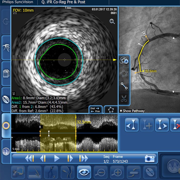 IVUS software image