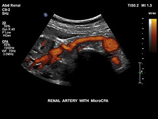 ABD RENAL MCPA