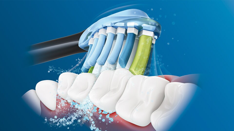 Sonicare Electric Toothbrushes – Best Sonic | Philips